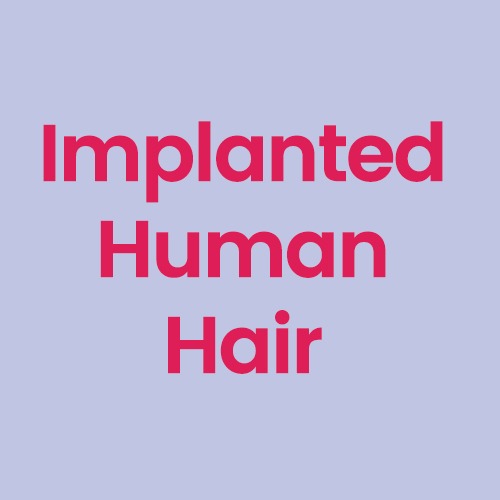 Implanted Human Hair