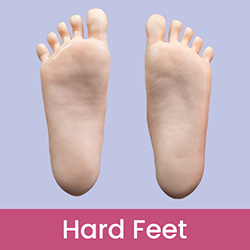 Hard Feet